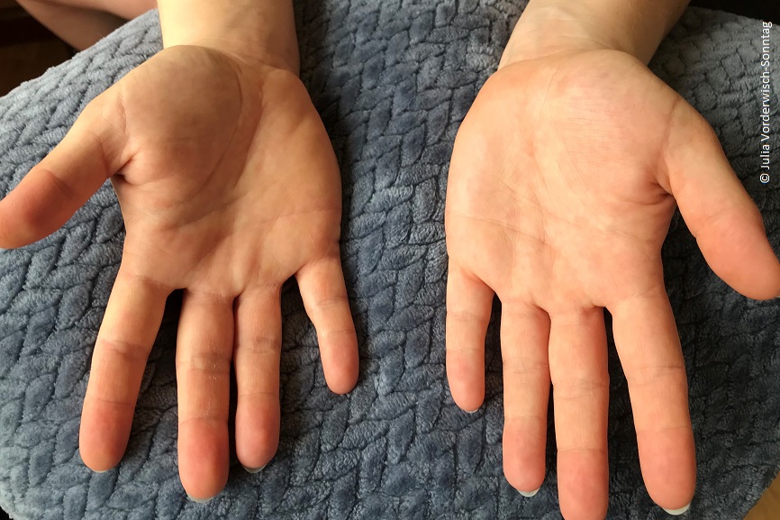 Ein paar Hände liegen mit den Handflächen nach oben auf einem grauen Kissen. 